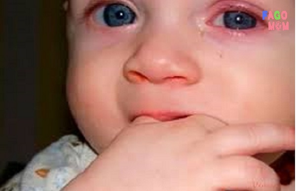 cách chữa viêm bờ mi mắt ở trẻ sơ sinh - Image 5