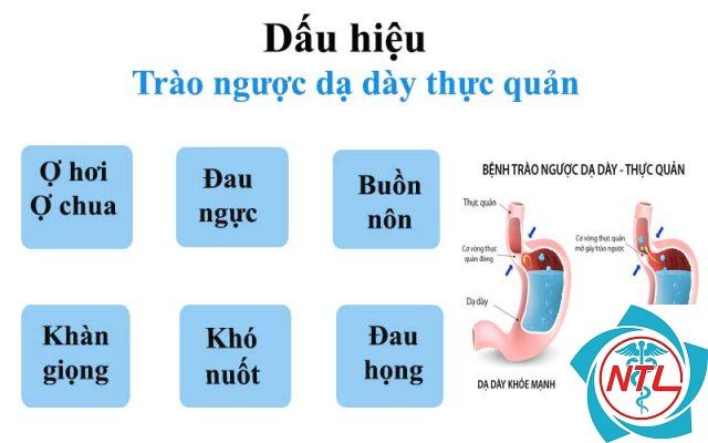 cách nhận biết bệnh trào ngược dạ dày thực quản - Image 5