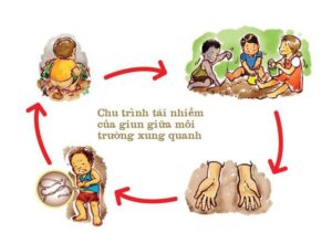 cách trị giun kim cho trẻ
