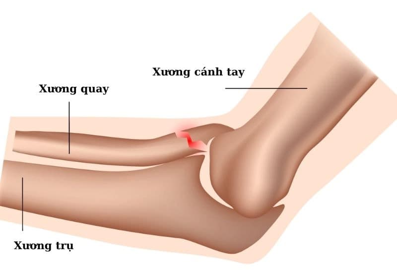 cẳng tay - Image 3