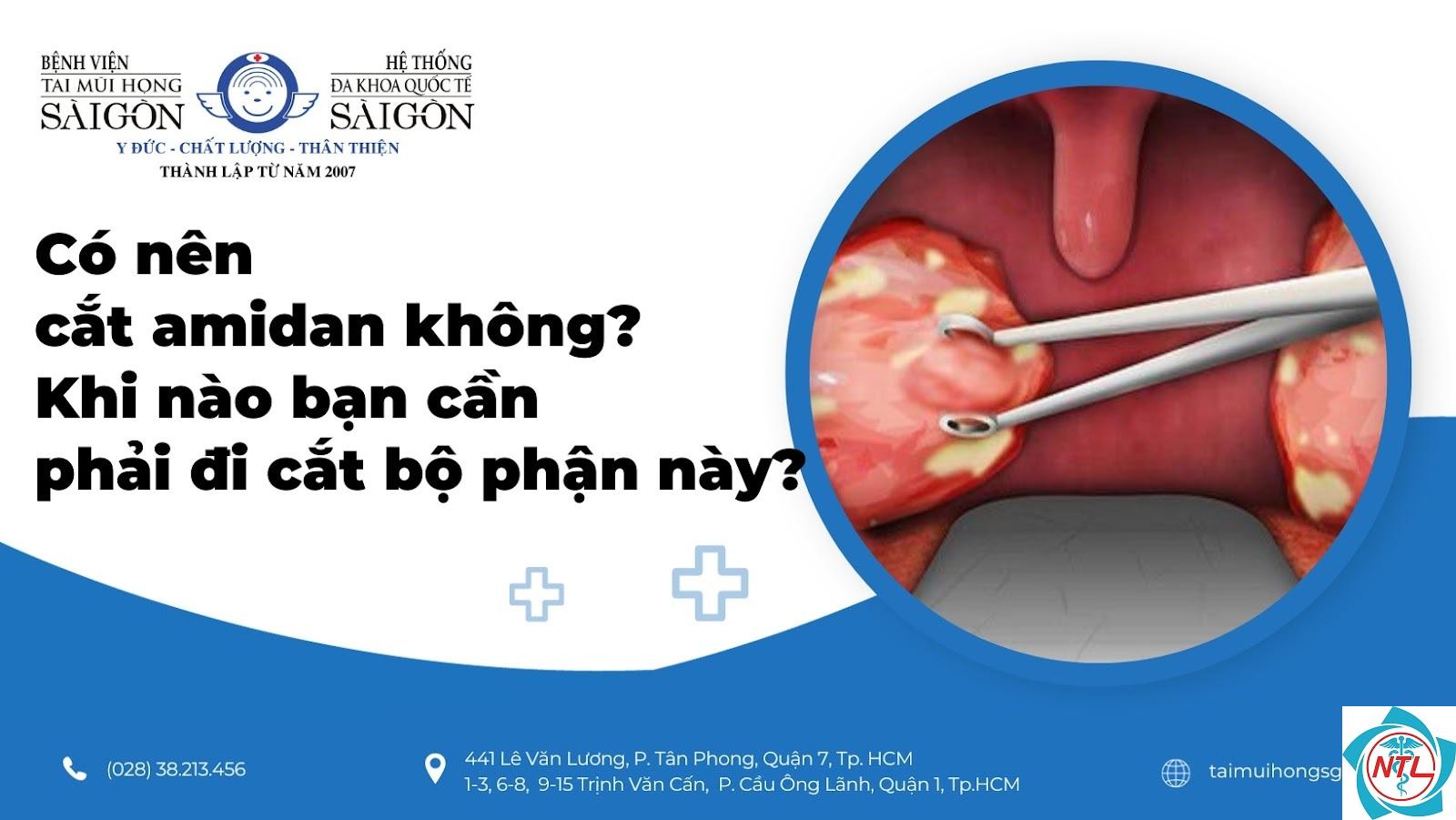 cắt amidan có đau không - Image 3