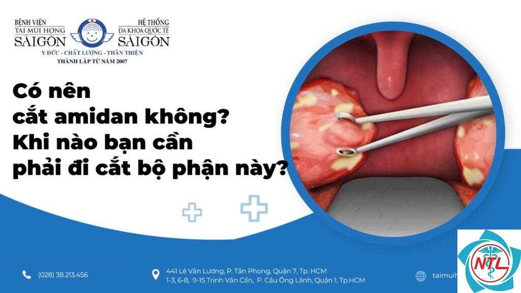 cắt amidan có sao không