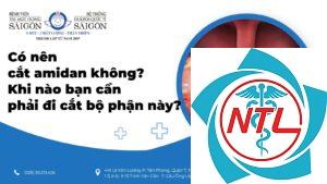 cắt amidan có sao không