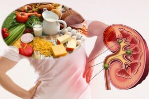 chăm sóc người bệnh suy thận