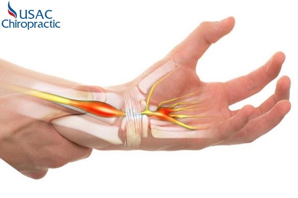 chăm sóc sau mổ hội chứng ống cổ tay - Image 4