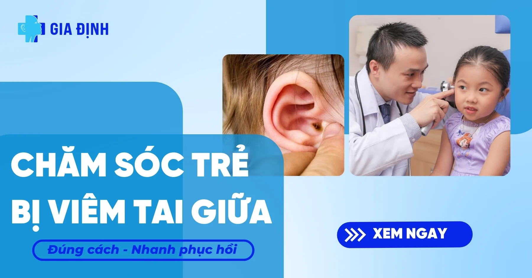 chăm sóc trẻ viêm tai giữa - Image 2