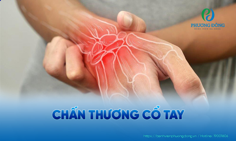 chấn thương cổ tay bao lâu khỏi - Image 3