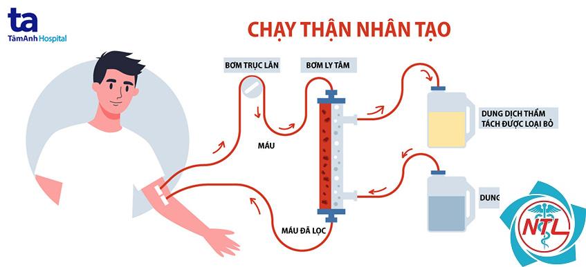 chạy thận nhân tạo và lọc máu