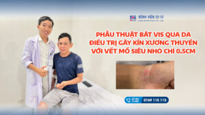 chi phí mổ xương thuyền