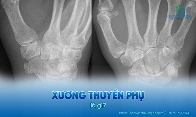 chi phí mổ xương thuyền - Image 4
