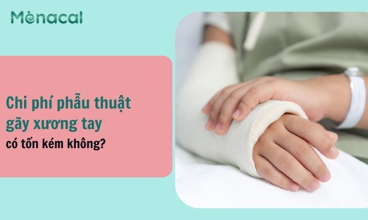 chi phí phẫu thuật gãy xương cánh tay - Image 4