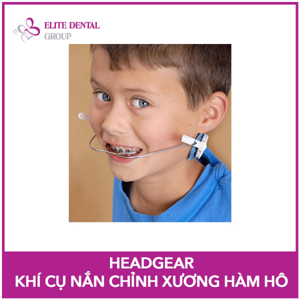chinh xuong ham - Image 5