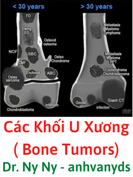 chồi xương - Image 4