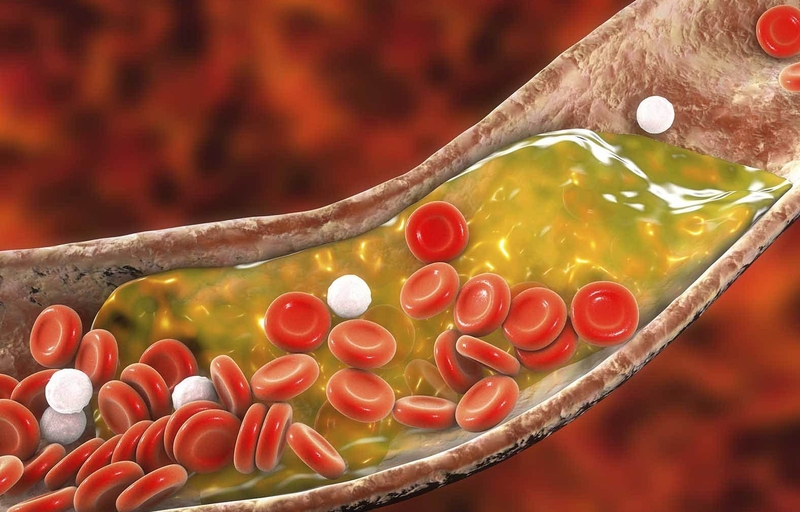 cholesterol cao ở người cao tuổi - Image 3