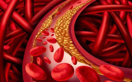 cholesterol cao ở người cao tuổi - Image 5