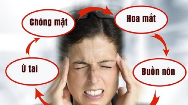 chóng mặt kèm buồn nôn - Image 4