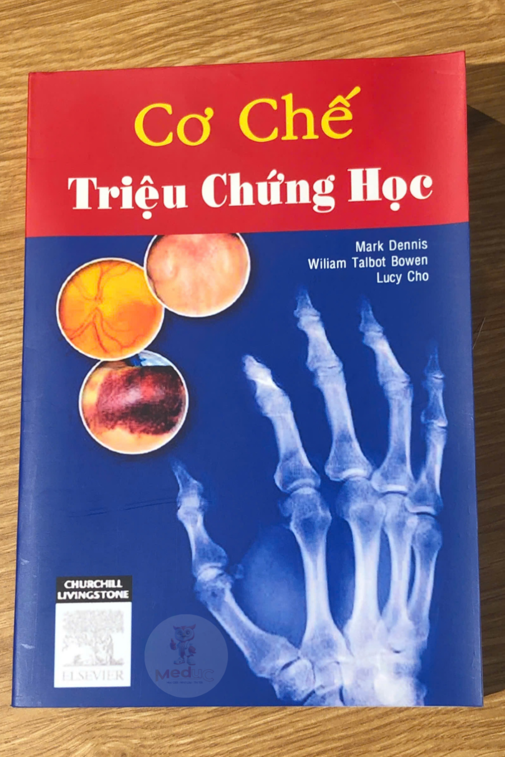 cơ chế triệu chứng - Image 3