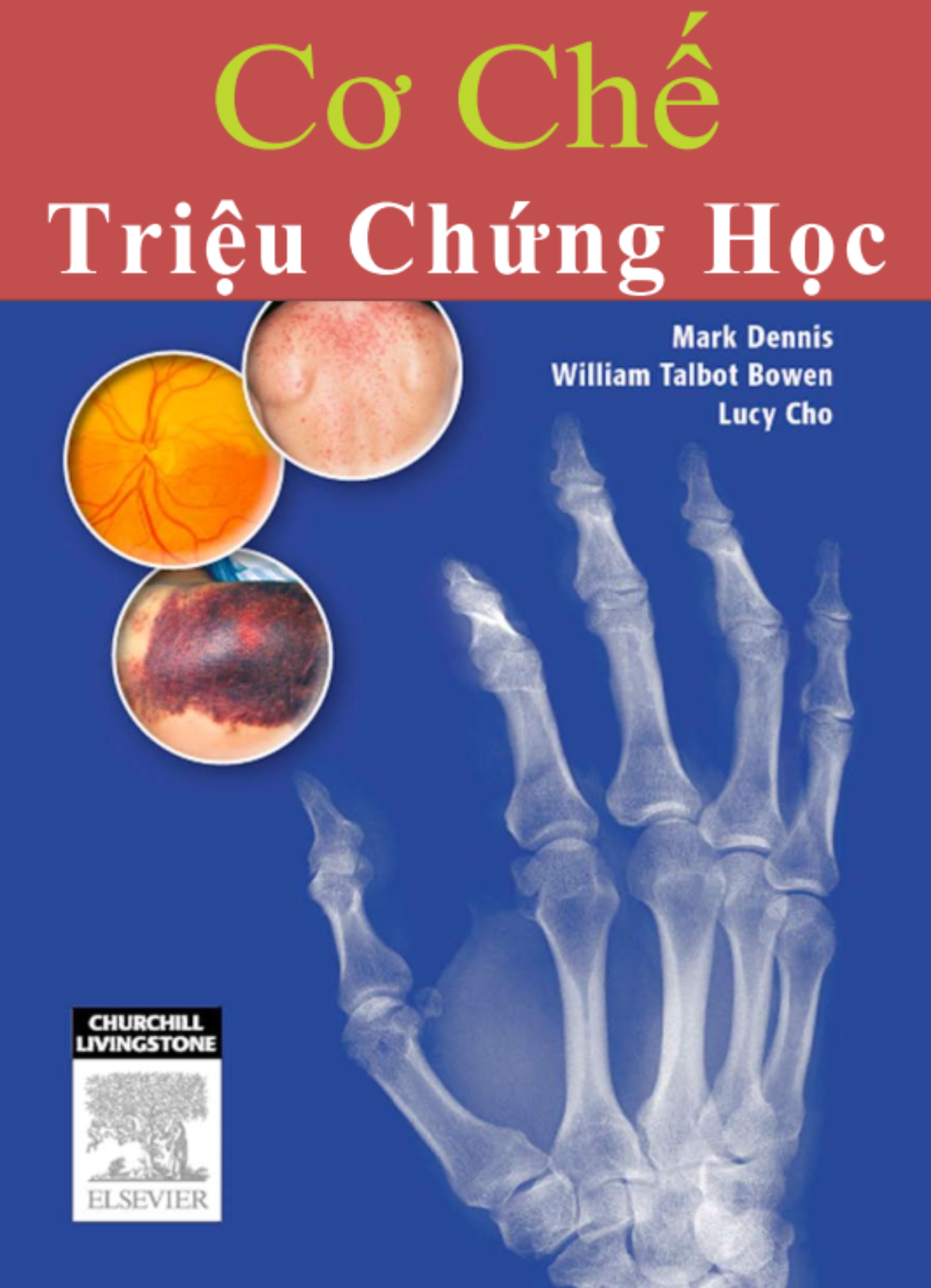 cơ chế triệu chứng - Image 1