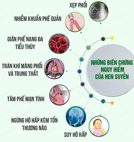cơn hen phế quản ban đêm - Image 5