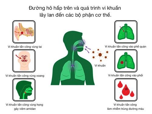 copd đợt cấp do nhiễm trùng - Image 4