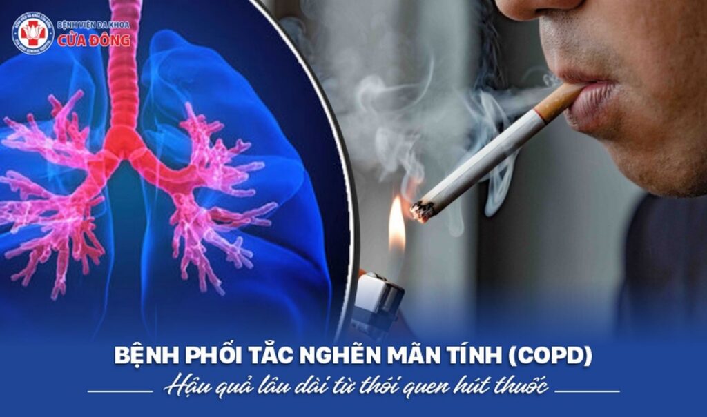 copd ở người hút thuốc lâu năm