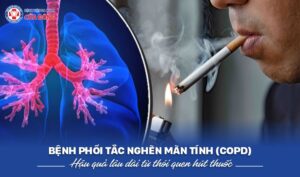 copd ở người hút thuốc lâu năm