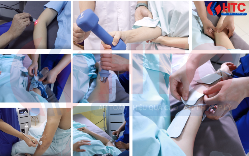 cứng khớp khuỷu tay sau bó bột - Image 5