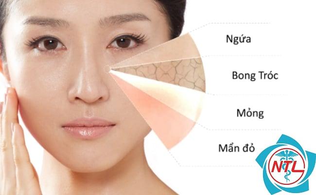 da mặt nhạy cảm - Image 2