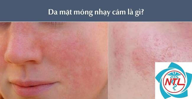 da mặt nhạy cảm - Image 4
