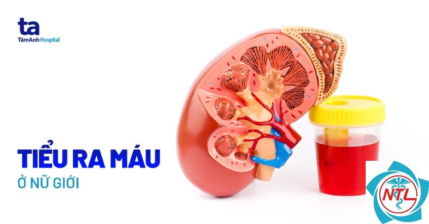 đái ra máu là bệnh gì - Image 2