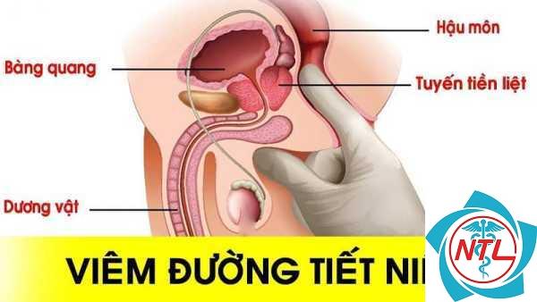 đái ra máu là bệnh gì - Image 4