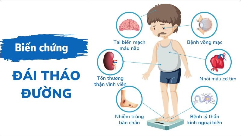đái tháo đường - Image 5