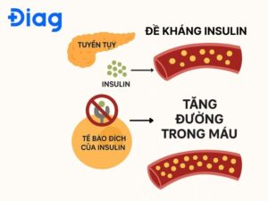 đái tháo đường là gì
