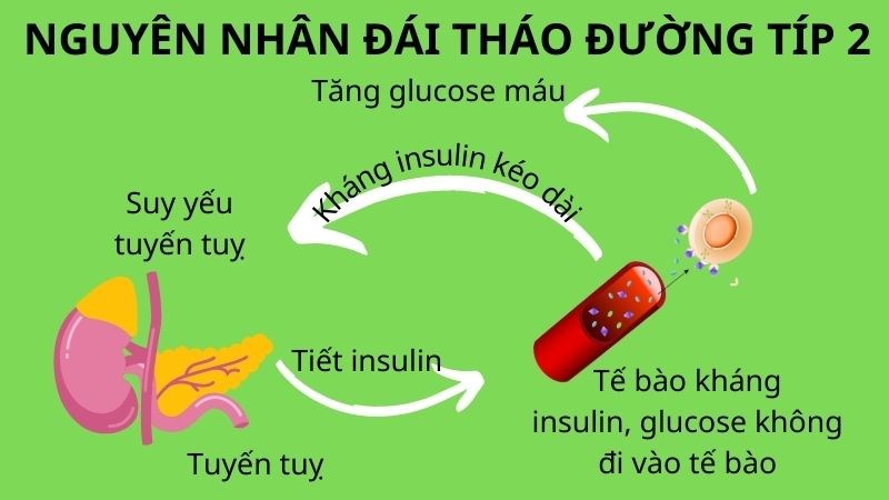 đái tháo đường type 2 ở người lớn - Image 4