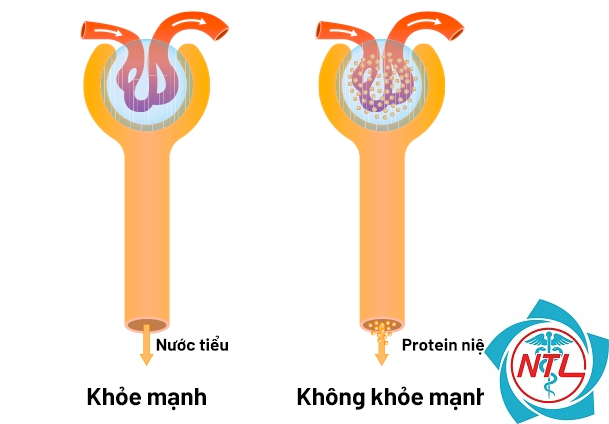 đạm niệu - Image 3