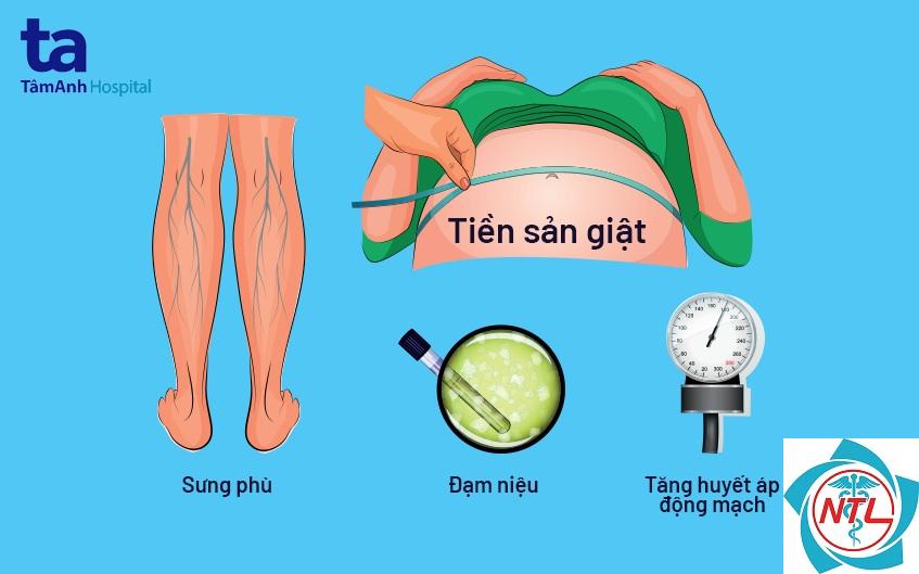 đạm niệu - Image 1