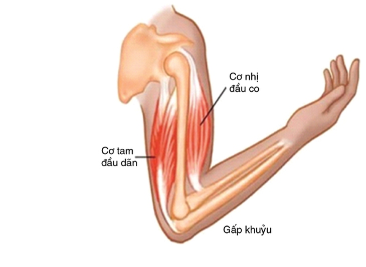 đau cơ duỗi cánh tay