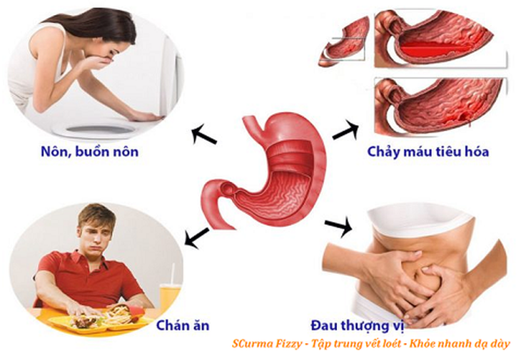 đau dạ dày kèm buồn nôn - Image 3