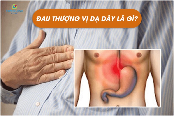 đau dạ dày là dấu hiệu gì - Image 4