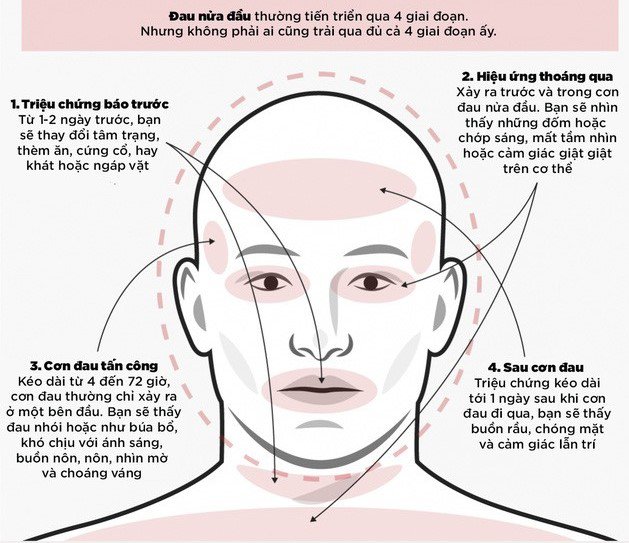 đau đầu là dấu hiệu bệnh gì - Image 2