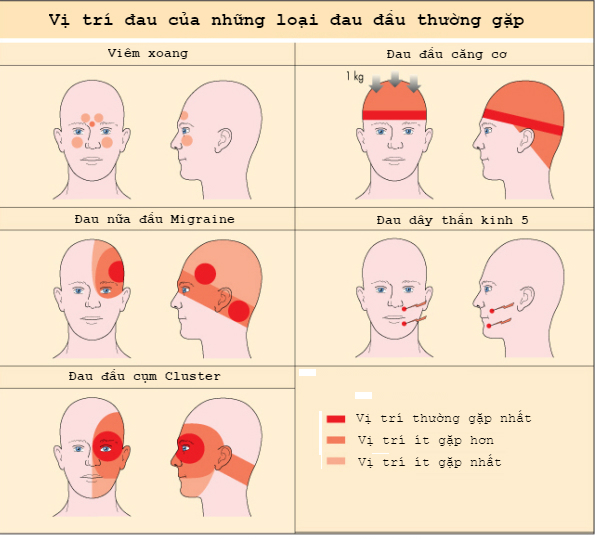 đau đầu là dấu hiệu bệnh gì - Image 4