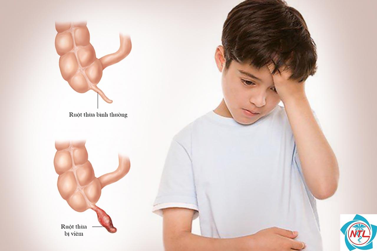 dấu hiệu đau ruột thừa ở trẻ nhỏ - Image 2