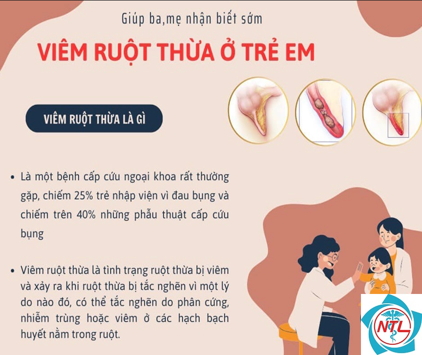 dấu hiệu đau ruột thừa ở trẻ nhỏ