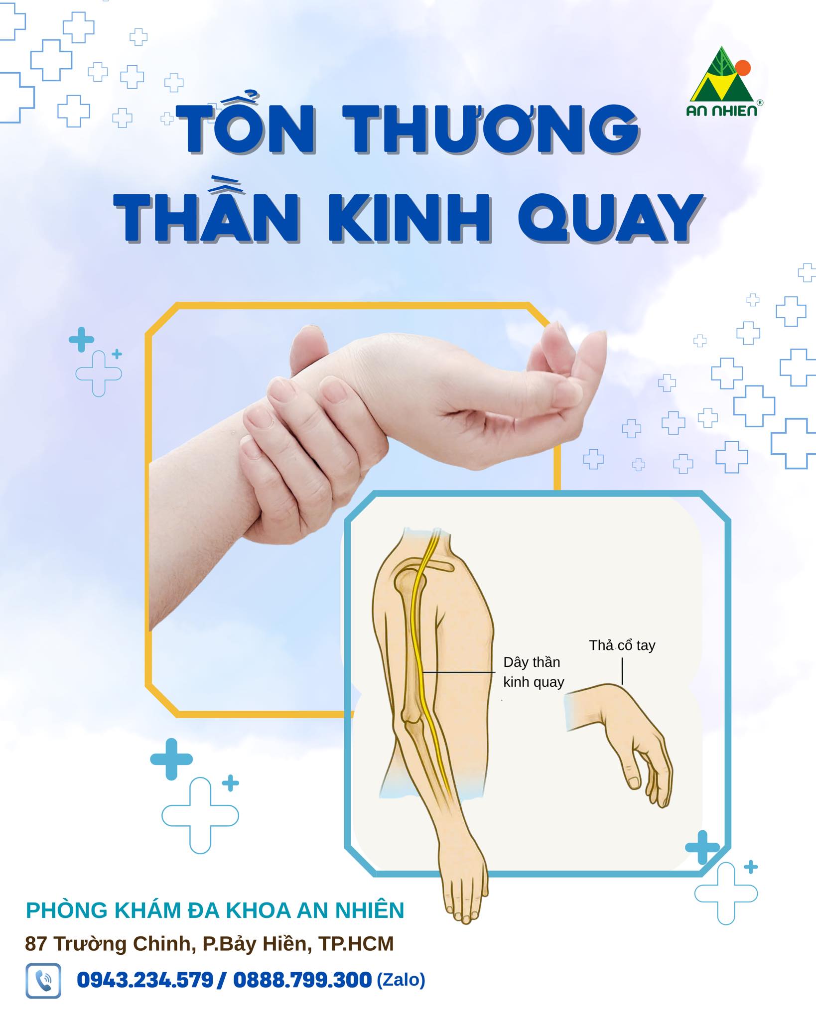 dấu hiệu hồi phục thần kinh quay - Image 3