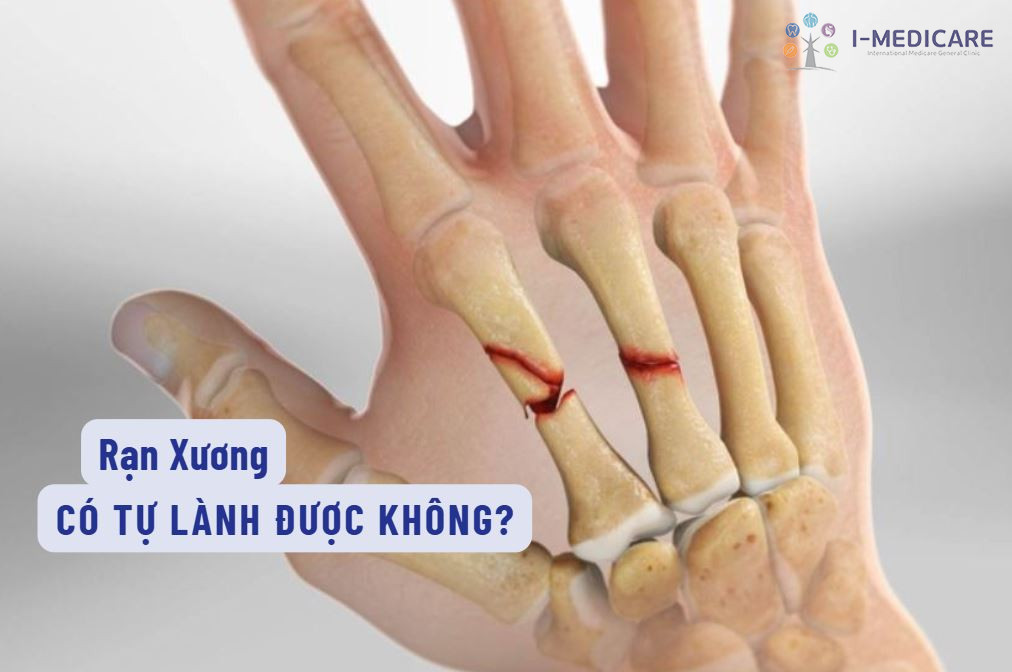 dấu hiệu rạn xương - Image 5