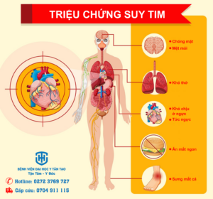 dấu hiệu suy tim
