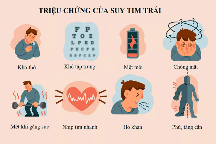 dấu hiệu suy tim - Image 4