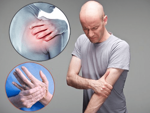 dấu hiệu tê tay trái