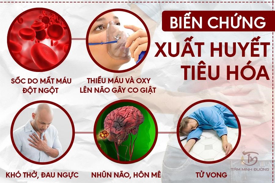 dấu hiệu xuất huyết tiêu hóa - Image 2
