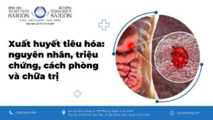 dấu hiệu xuất huyết tiêu hóa